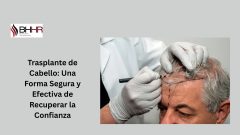 Transplante de Cabello: Una Forma Segura y Efectiva de Recuperar la Confianza