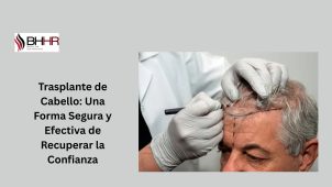 transplante de cabello