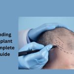 Understanding Hair Transplant Cost: A Complete Pricing Guide