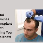 What Determines Hair Transplant Cost? Everything You Need to Know