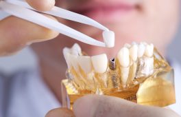 Dental Aligners Cost in Pune: Treatment Cost, Benefits & FAQs