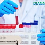 CBC Blood Test in Pune – Accurate Results from Trusted Labs