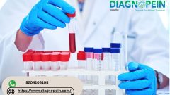 CBC Blood Test in Pune – Accurate Results from Trusted Labs